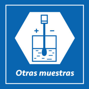 Otras muestras